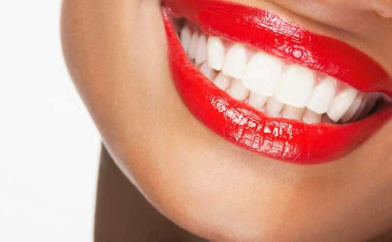 Белоснежная улыбка: как отбелить зубы и поддерживать белоснежную улыбку в домашних условиях