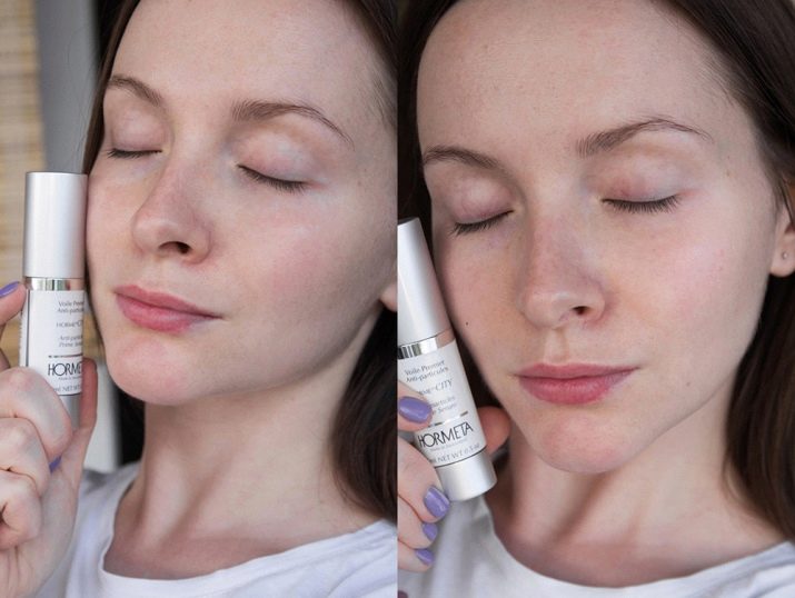 Косметика Hormeta: переваги і недоліки. Огляд продукції, вибір і використання