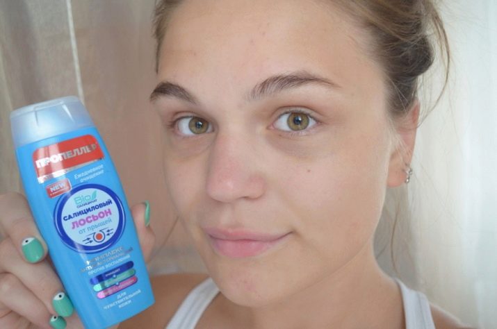 Косметика «Пропелер»: огляд уходових косметичних засобів проти прищів, відгуки косметологів