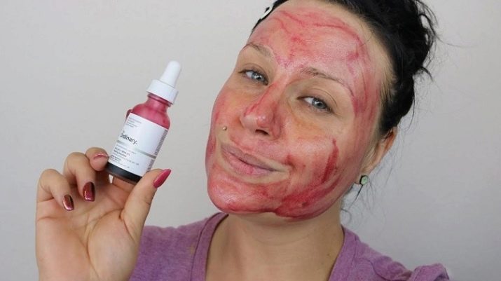Косметика The Ordinary: опис засобів для догляду за шкірою обличчя. Як користуватися? Відгуки косметологів