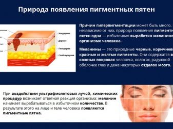 Косметика від пігментних плям на обличчі: вибираємо відбілюючий засіб проти пігментації. Огляд виробників: Floresan «Білий льон», Bioscreen та інші