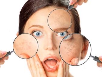 Косметика від пігментних плям на обличчі: вибираємо відбілюючий засіб проти пігментації. Огляд виробників: Floresan «Білий льон», Bioscreen та інші