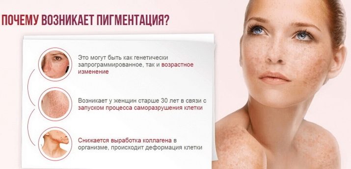 Косметика від пігментних плям на обличчі: вибираємо відбілюючий засіб проти пігментації. Огляд виробників: Floresan «Білий льон», Bioscreen та інші