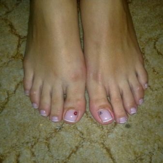 Педикюр френч (106 фото): красивий кольоровий французький дизайн в білих і рожевих або червоних відтінках на ногах