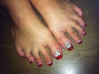 Педикюр френч (106 фото): красивий кольоровий французький дизайн в білих і рожевих або червоних відтінках на ногах