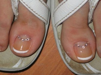 Педикюр френч (106 фото): красивий кольоровий французький дизайн в білих і рожевих або червоних відтінках на ногах