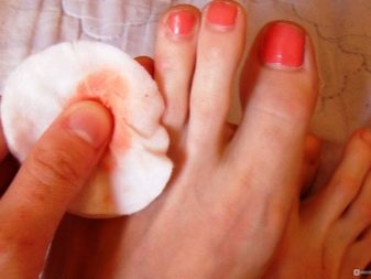 Педикюр френч (106 фото): красивий кольоровий французький дизайн в білих і рожевих або червоних відтінках на ногах