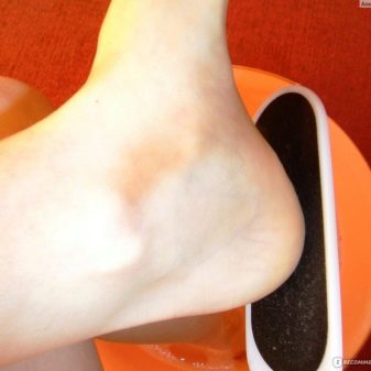 Педикюр френч (106 фото): красивий кольоровий французький дизайн в білих і рожевих або червоних відтінках на ногах