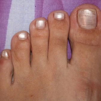 Педикюр на море (62 фото): як зробити гарний пляжний педикюр в одному стилі? Ідеї дизайну у відпустку