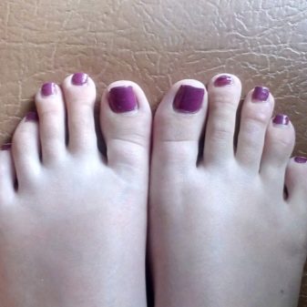 Педикюр на море (62 фото): як зробити гарний пляжний педикюр в одному стилі? Ідеї дизайну у відпустку