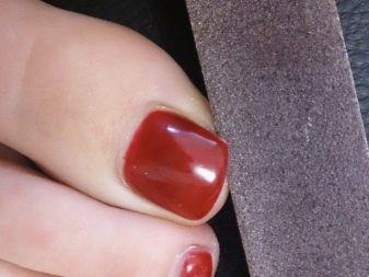 Педикюр на море (62 фото): як зробити гарний пляжний педикюр в одному стилі? Ідеї дизайну у відпустку