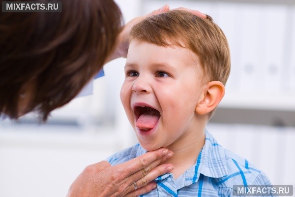Причини появи білих плям у дитини на мові та їх лікування