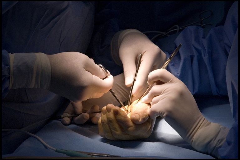 Що означає якщо сниться операція, лікарня або операційний стіл: тлумачення сонників
